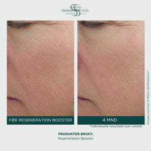 Jan Marini – Regeneration Booster Face Lotion (30ml)