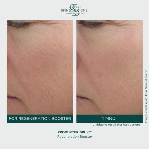 Jan Marini – Regeneration Booster Face Lotion (30ml)